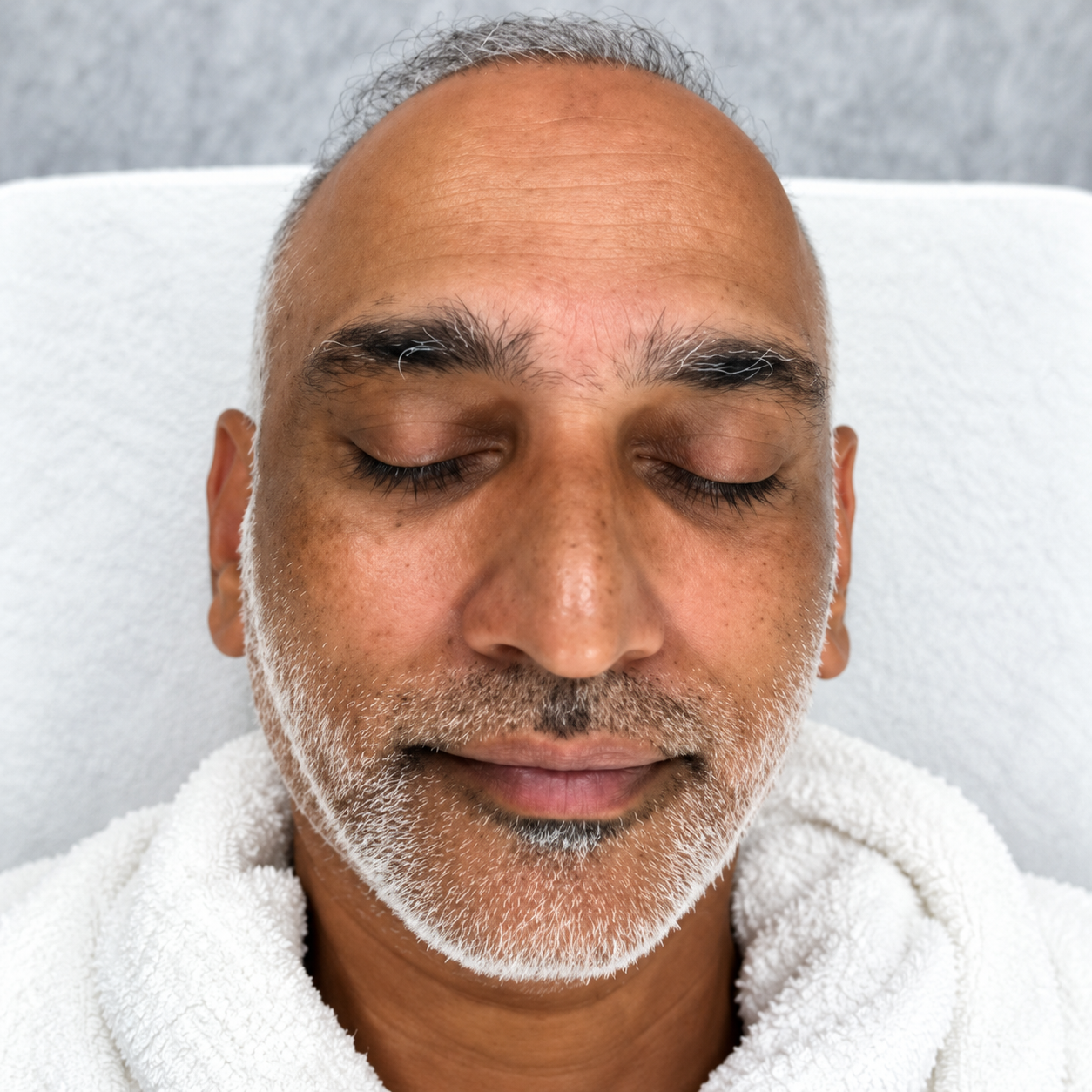 Before anti-ageing treatment