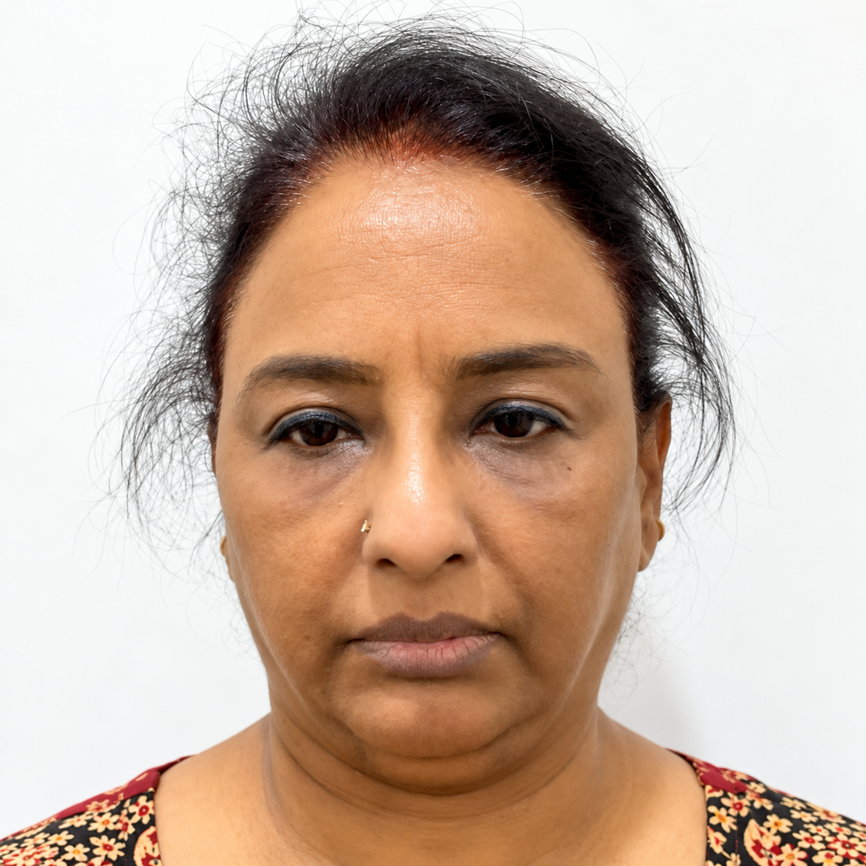 Before anti-ageing treatment