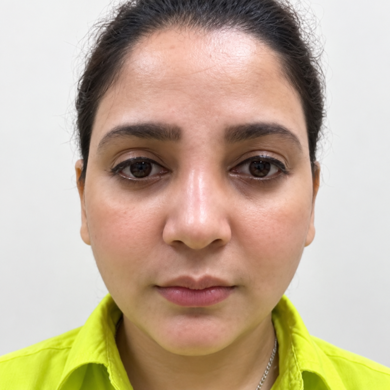After skin brightening