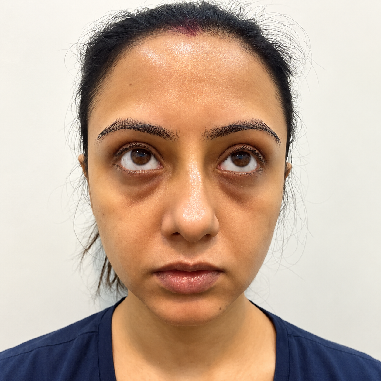 Before skin brightening
