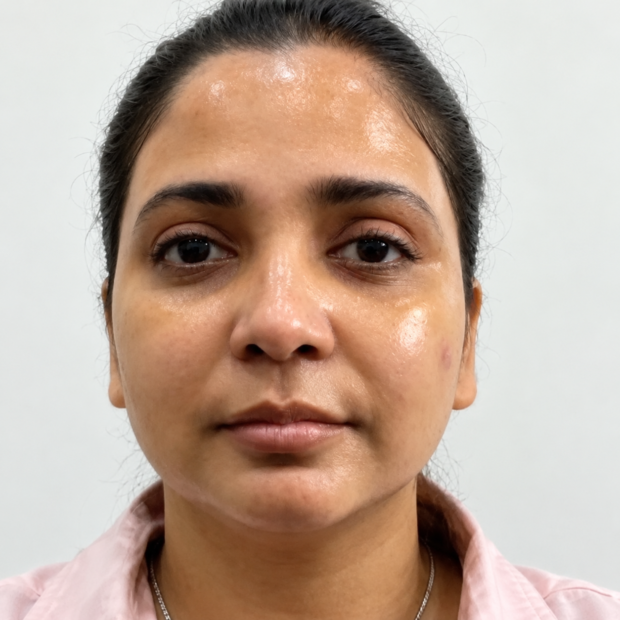 Before skin brightening