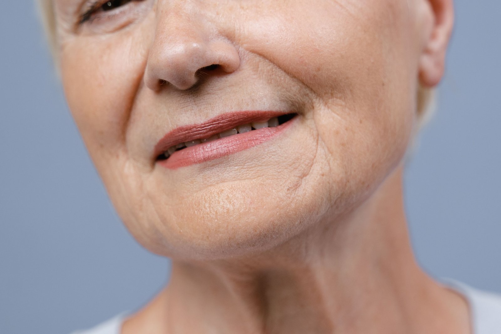 Fine lines and wrinkles