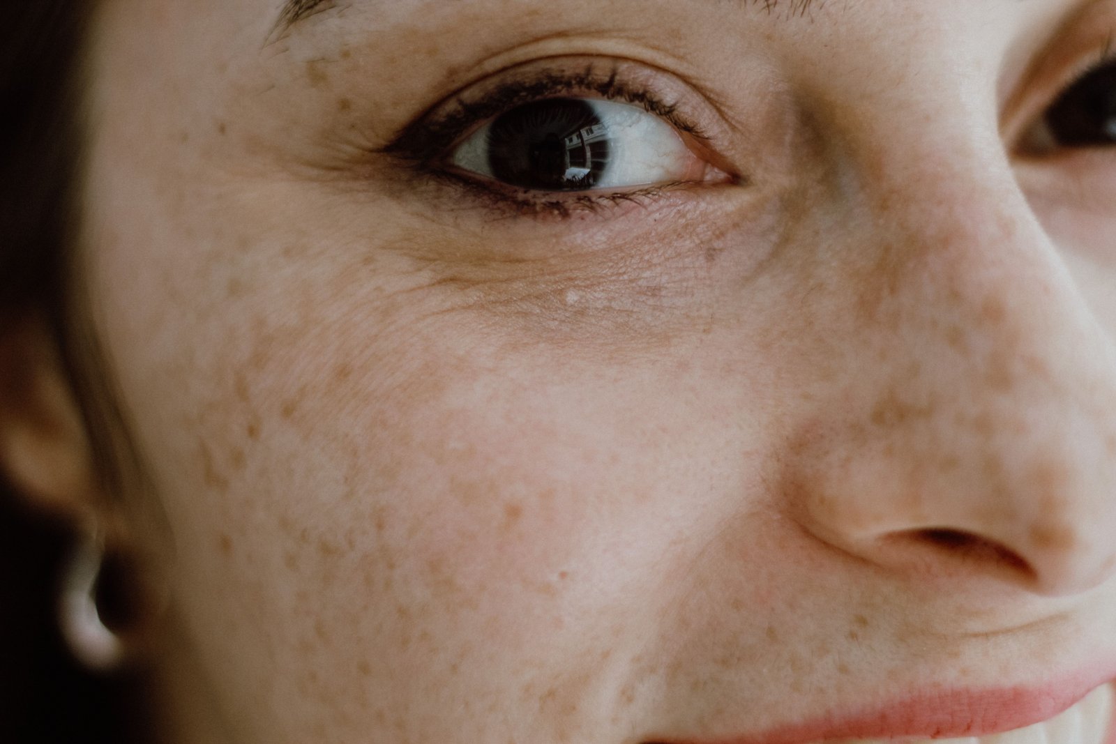 Pigmentation and tanning treatment