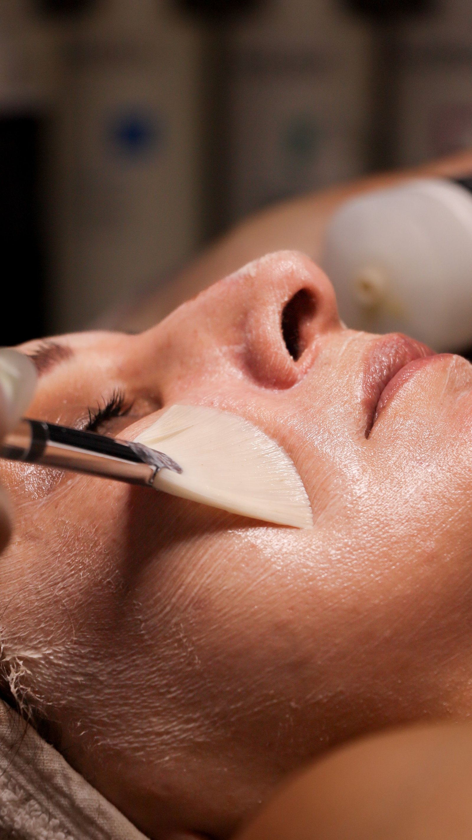 Medically graded peels