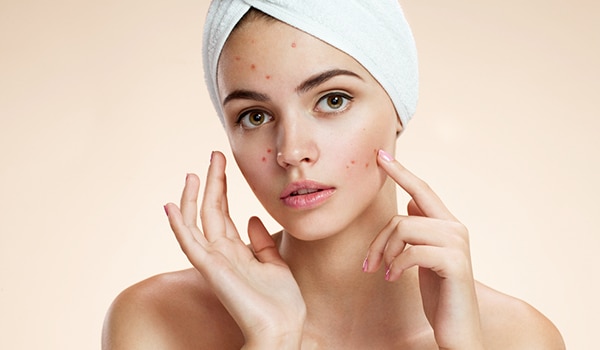 Acne & acne scar correction