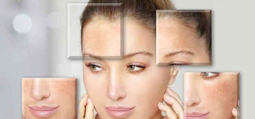 Best Clinics for Skin Lightening Treatment in Bangalore