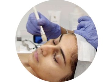Skin Brightening – during treatment Skin Brightening - during treatment